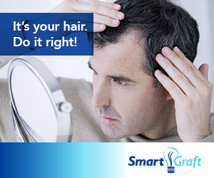 SmartGraft Hair Restoration Before and After Photos
