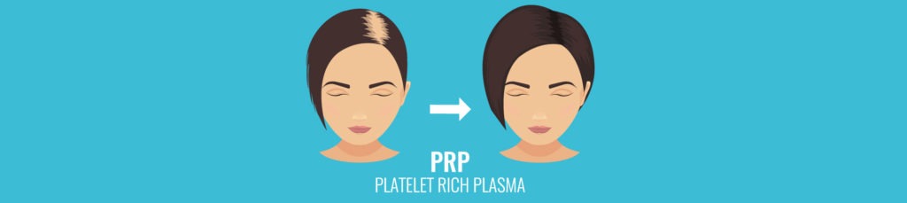 PRP Injections For Hair Loss in Beverly Hills